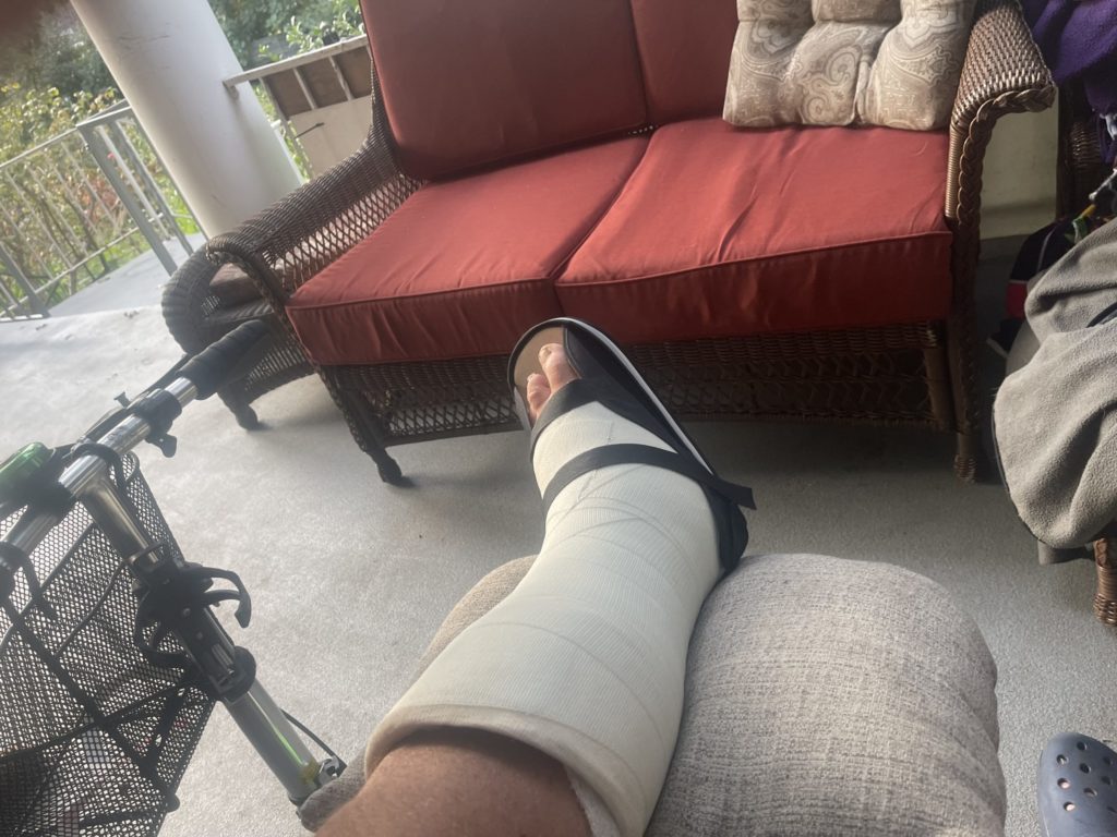 Dave transitioned to a cast to continue healing from Charcot foot syndrome.