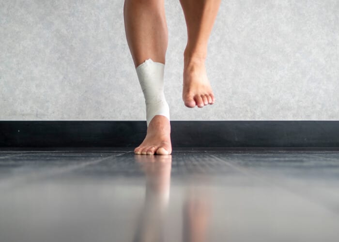 Woman standing on one foot with wrapped ankle