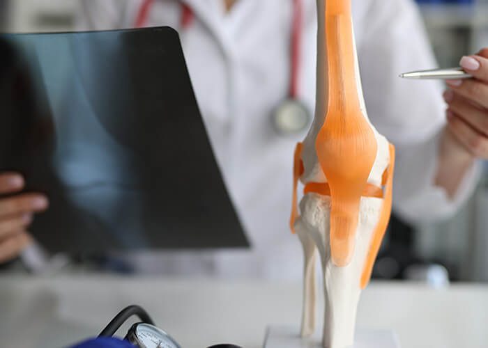 Knee skeleton