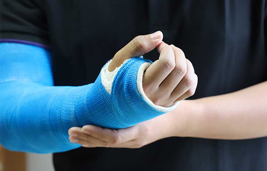 Person holding arm in a bluecast